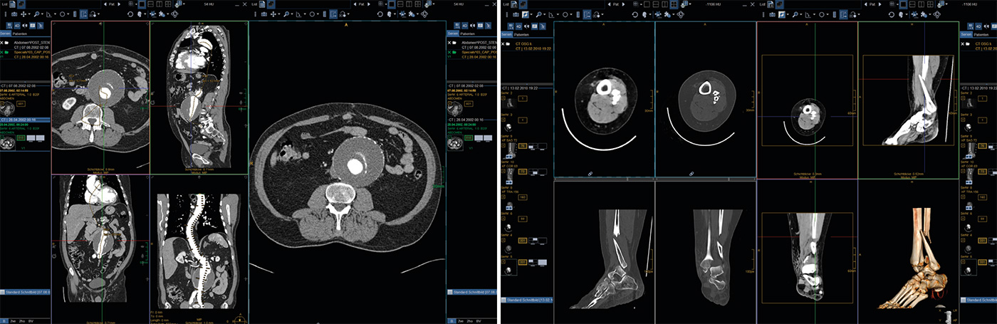 DeepUnity Diagnost – Dedalus DACH